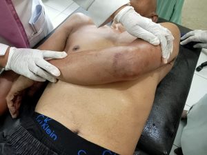 Pria Pedagang Sayur di Aek Nabara Ditikam Tetangga hingga Tewas